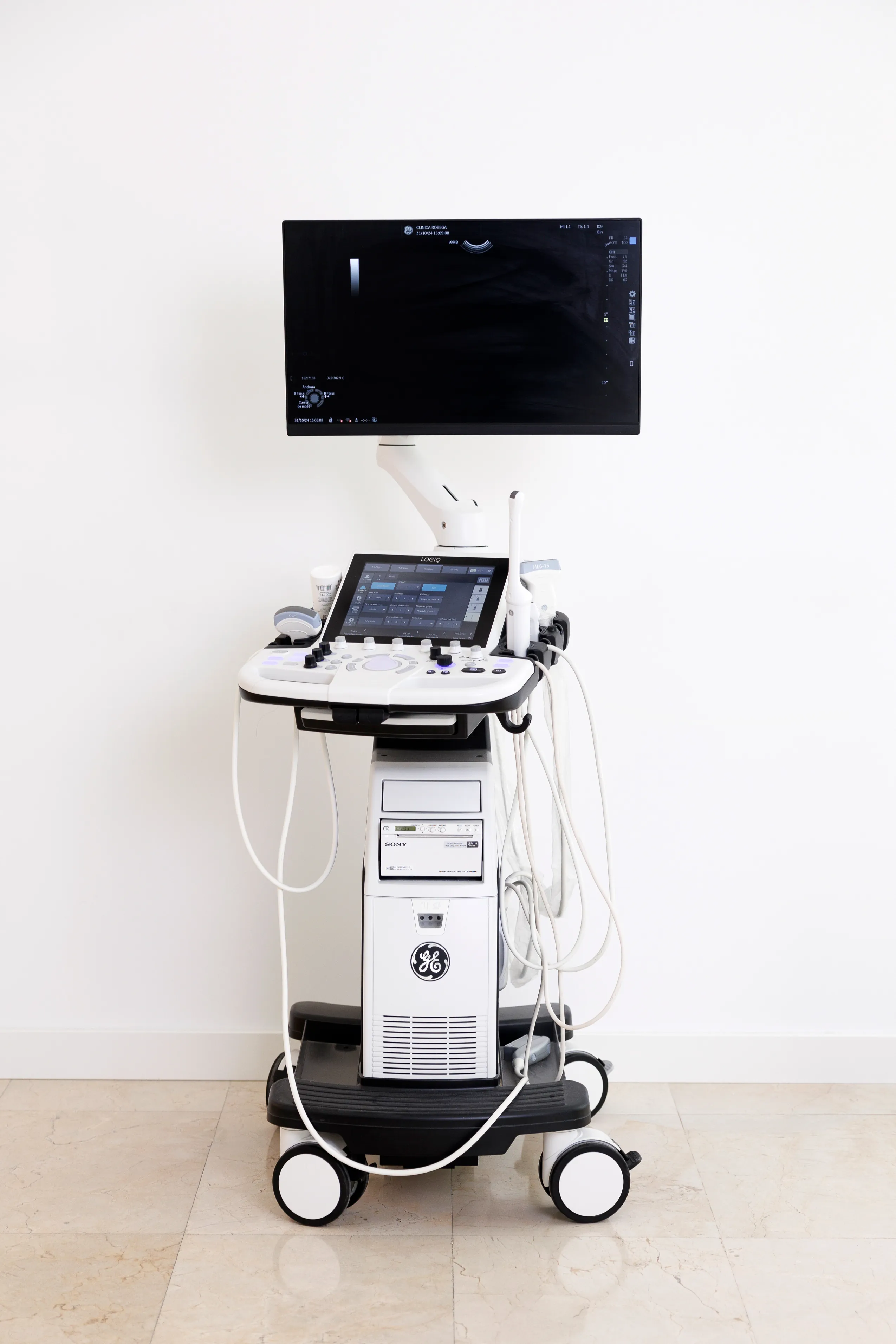Endolift
